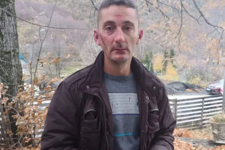 (VIDEO) TUČA U ŠAVNIKU: Napadnut član biračkog odbora ispred DF-a, uhapšene četiri osobe